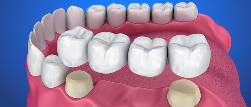 Dental Clinic Keelkattalai